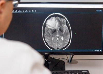 تشخیص سرطان مغز با هوش مصنوعی