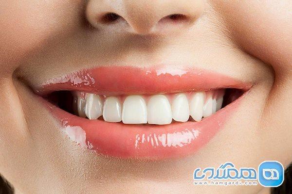 9 راهی که باعث می شوند ناخواسته دندان هایتان را لک کنید