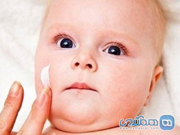 خشکی پوست بچه ها را در زمستان جدی بگیرید