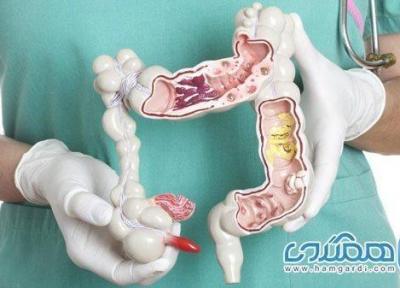 علائم ابتلا به سرطان روده