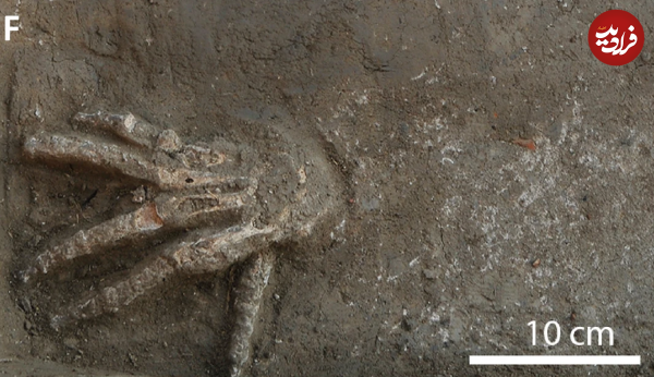 راز دست هایی که 3500 سال پیش قطع شدند